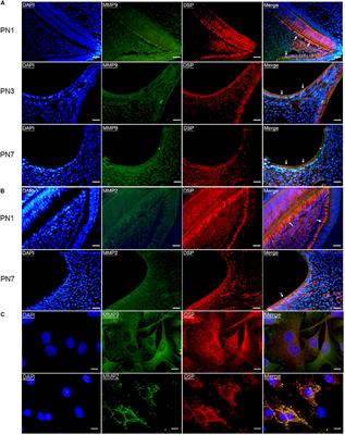 Gelatinases Cleave Dentin Sialoprotein Intracellularly